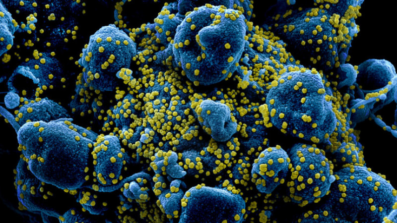 Вирус жұқтырған адамның жасушасы. Микроскоптан түсірілген. © NIAID