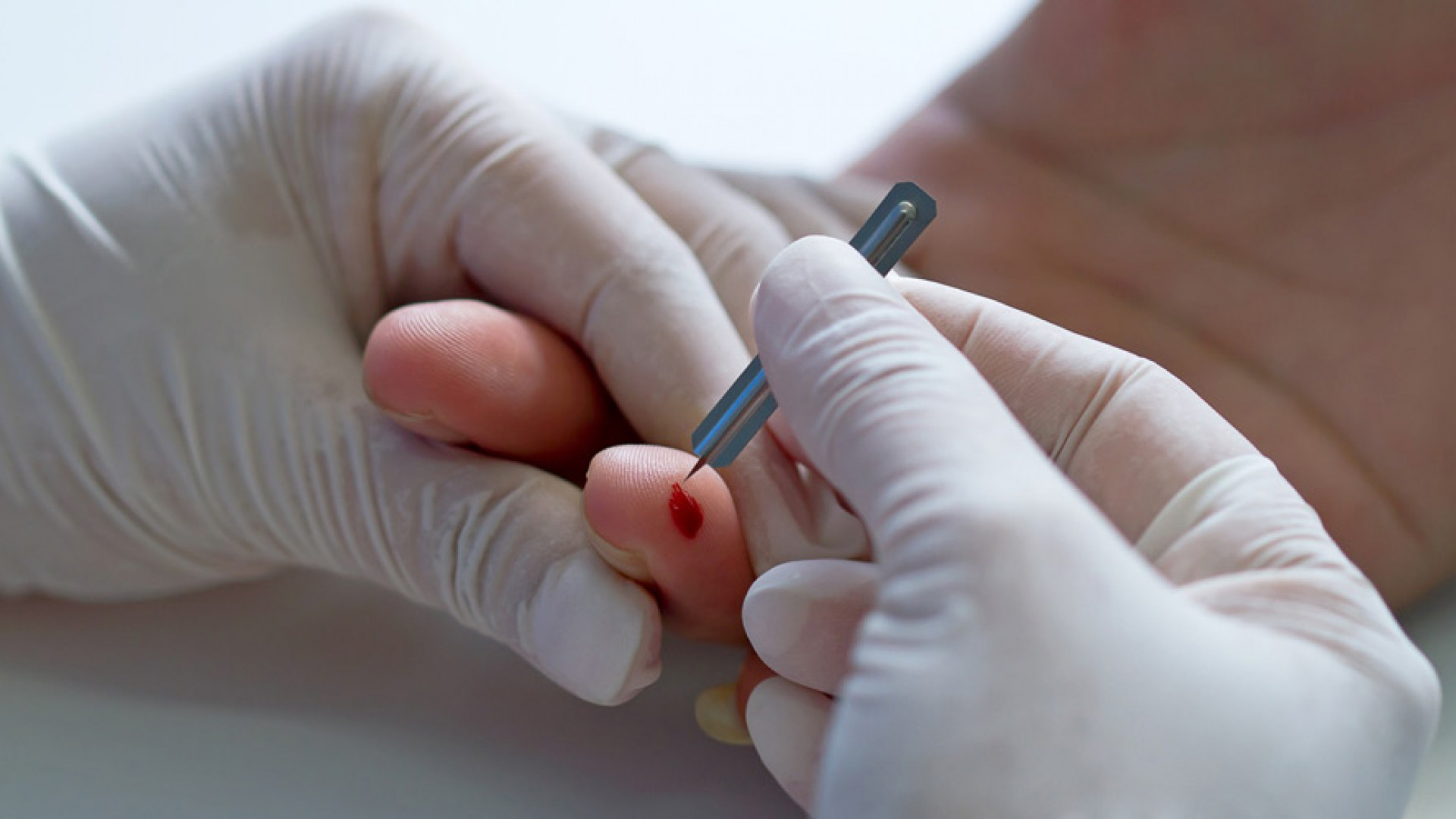 Анализ крови из пальца можно ли есть. Прокол пальца для взятия крови.
